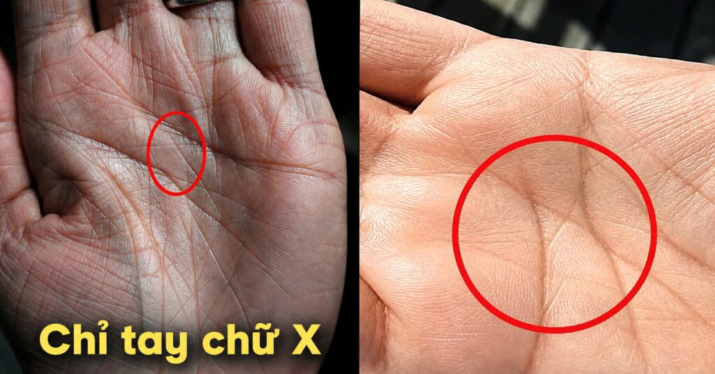 Chỉ tay chữ X